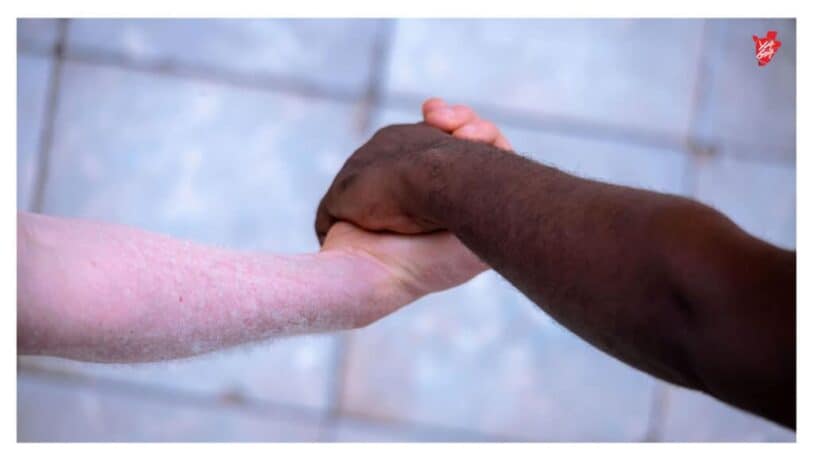 Jeanine, l’albinos de Ruziba qui veut quitter l’ombre et briser les chaînes de la honte