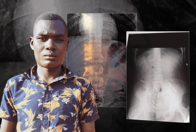 Au Kenya, le rêve d’emploi d’un jeune Burundais confronté aux violences